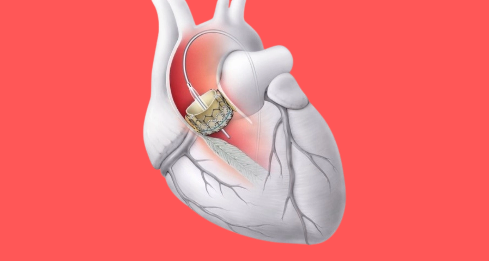 kapak rahatsızlıkları 1