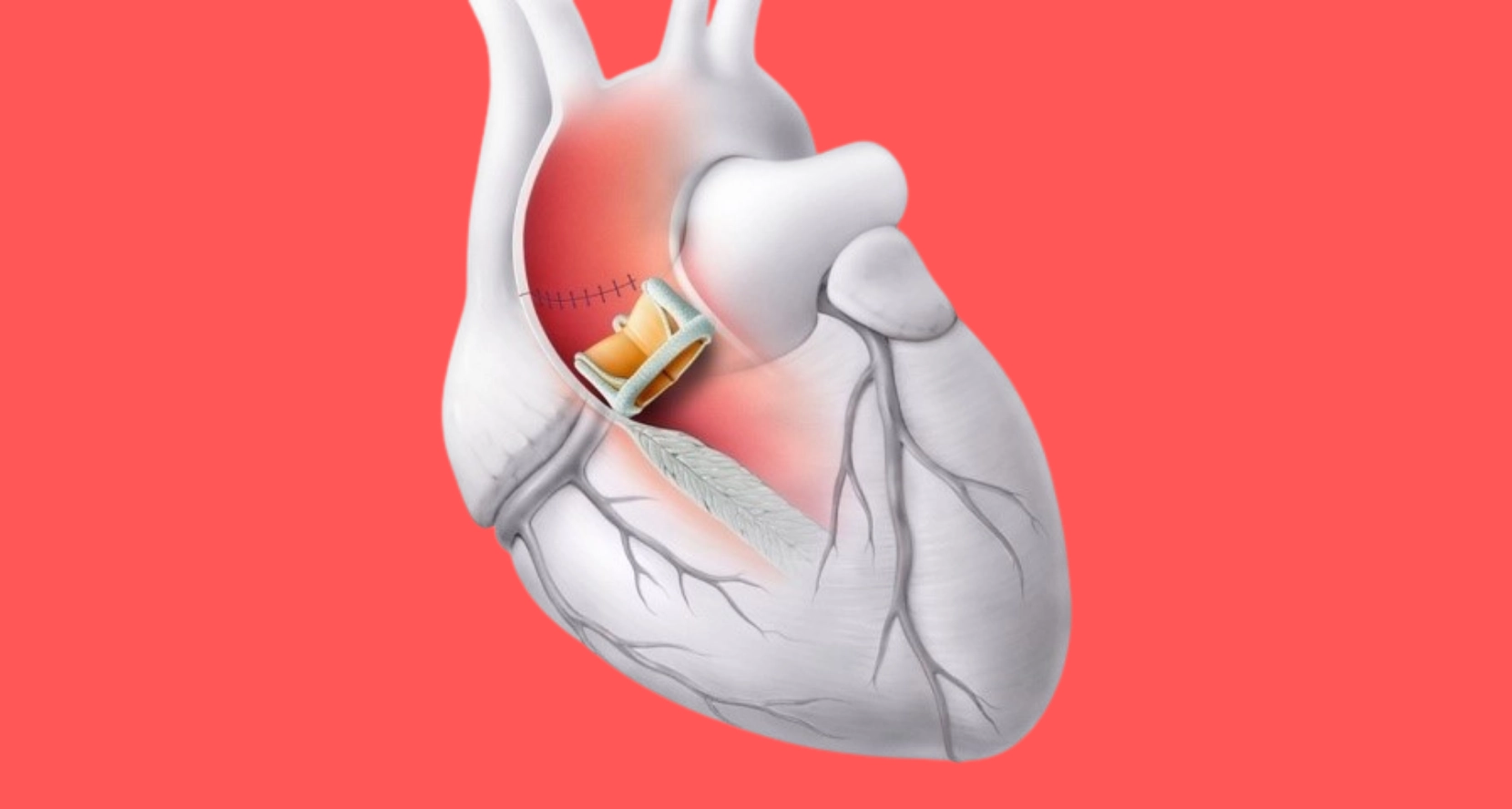 kapak rahatsızlıkları 2